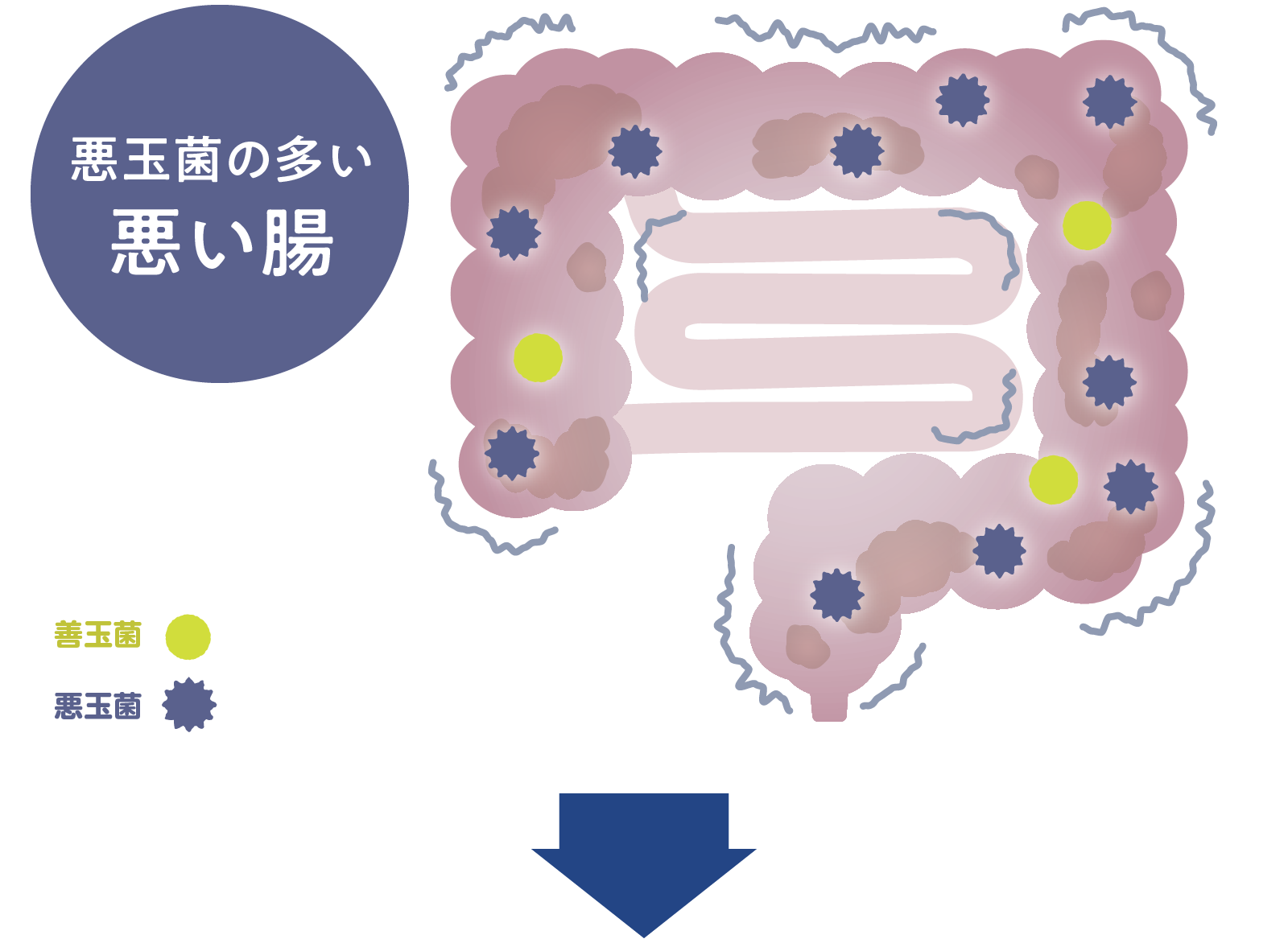 悪玉菌の多い悪い腸