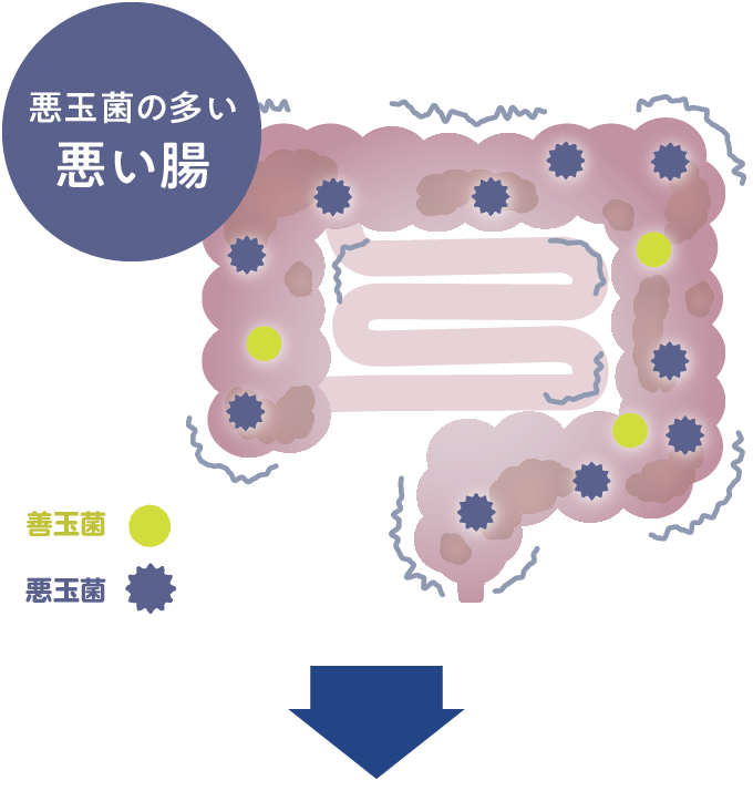 悪玉菌の多い悪い腸